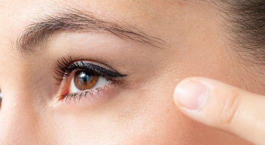 How to get rid of Dark Circles?