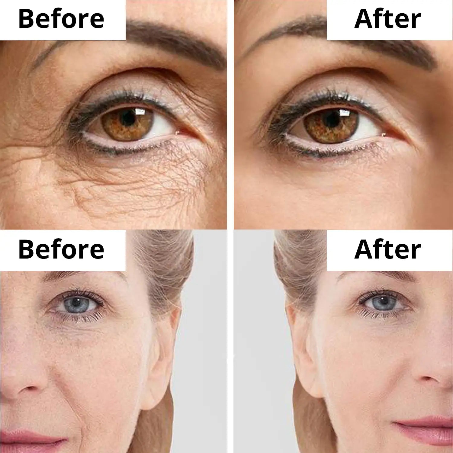 Argireline Anti-Aging Argireline Anti-Aging